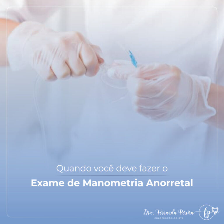 Quando você deve fazer o exame de manometria anorretal