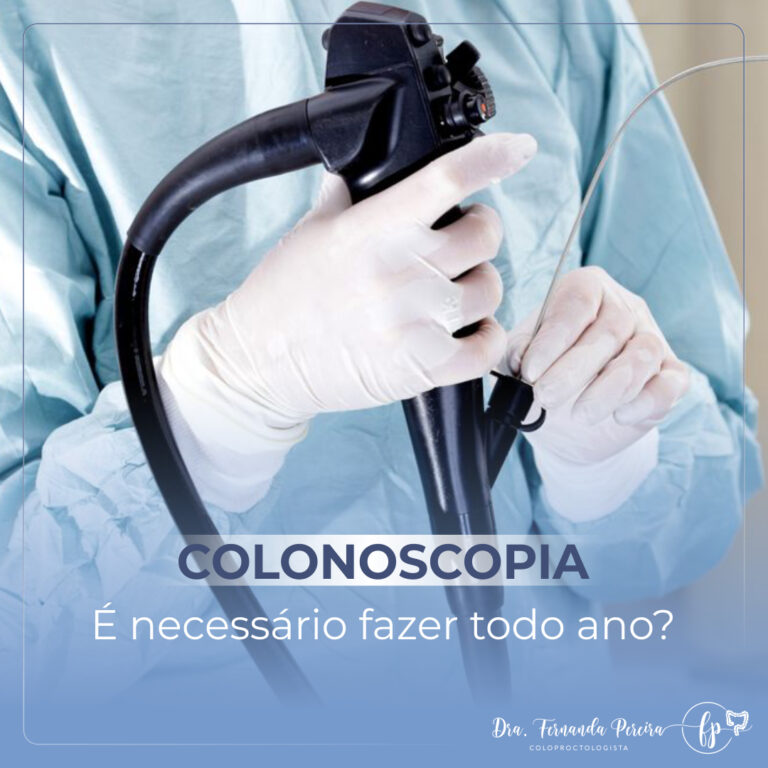 É necessário fazer a colonoscopia todo ano