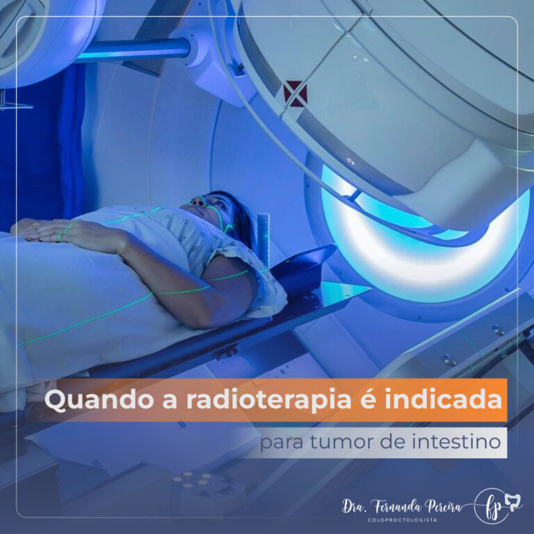 Quando a radioterapia é indicada para tumor de intestino